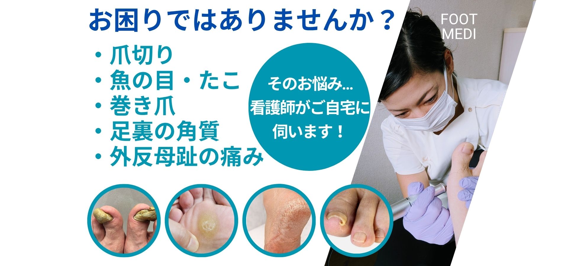 訪問フットケアFootMedi 施術の様子